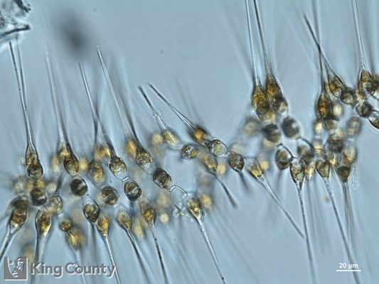 Photo of Asterionellopsis glacialis